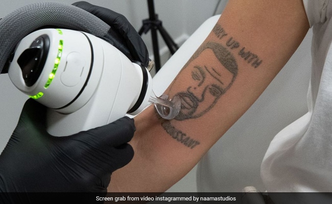 This London Studio Is Offering Free Kanye West Tattoo Removal